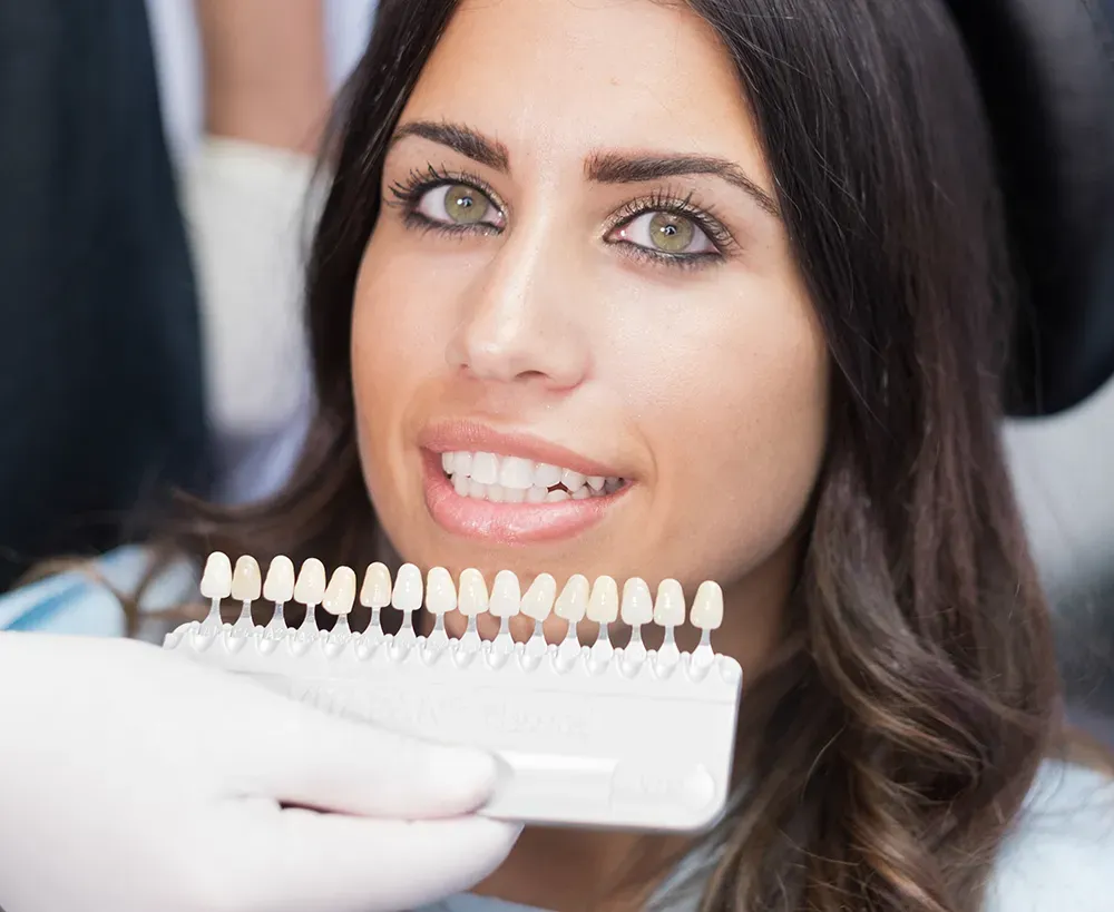 Woman smiling as a porcelain shade guide is held up to her teeth