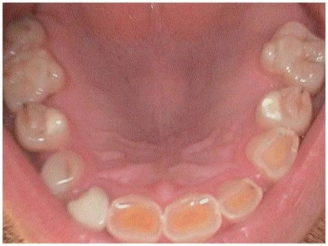 Smile Gallery result, before